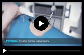 Multimedia Patient Education - Thomas Youm MD FACS - Hip Arthroscopy